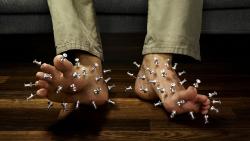 иглотерапия фото